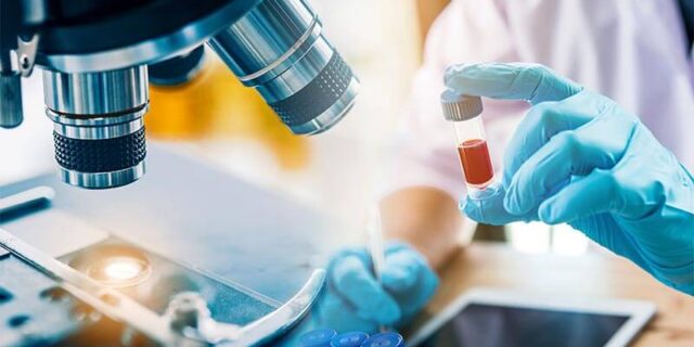 professional holding blood test tube bradenton research center